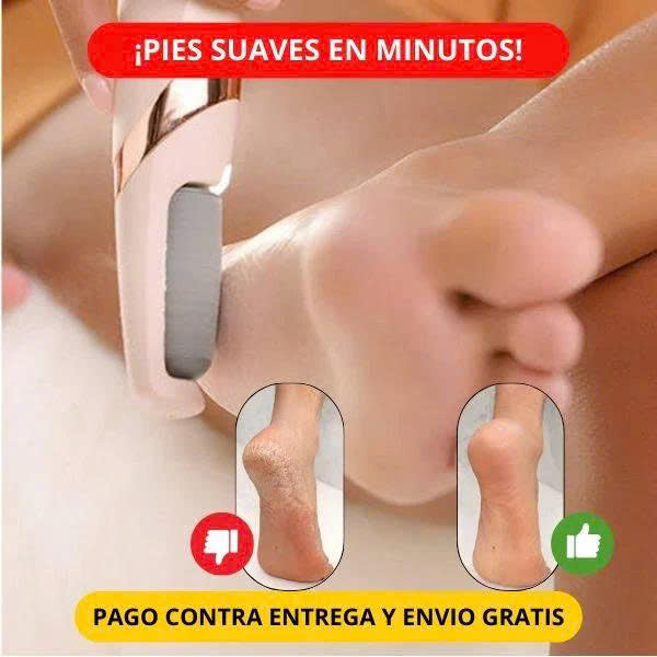 (30% DE DESCUENTO) Removedor de Callos Eléctrico – Pies suaves al instante